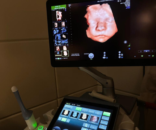 img fetal